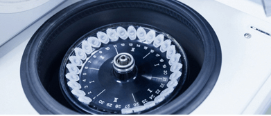 에이프로젠바이오로직스 주가전망 유상증자 거래정지 감자 권리락