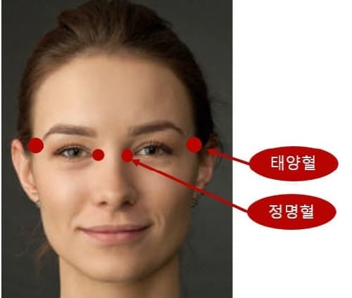 태양혈,정명혈