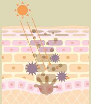 피부가 타는 과정