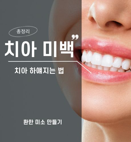 치아 미백 총정리