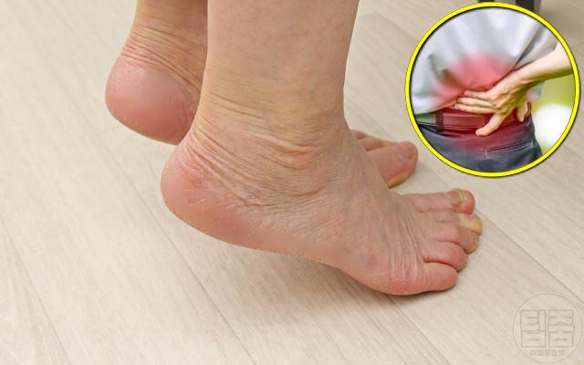 추간판탈출증 증상 다리힘 약해짐 디스크탈출증