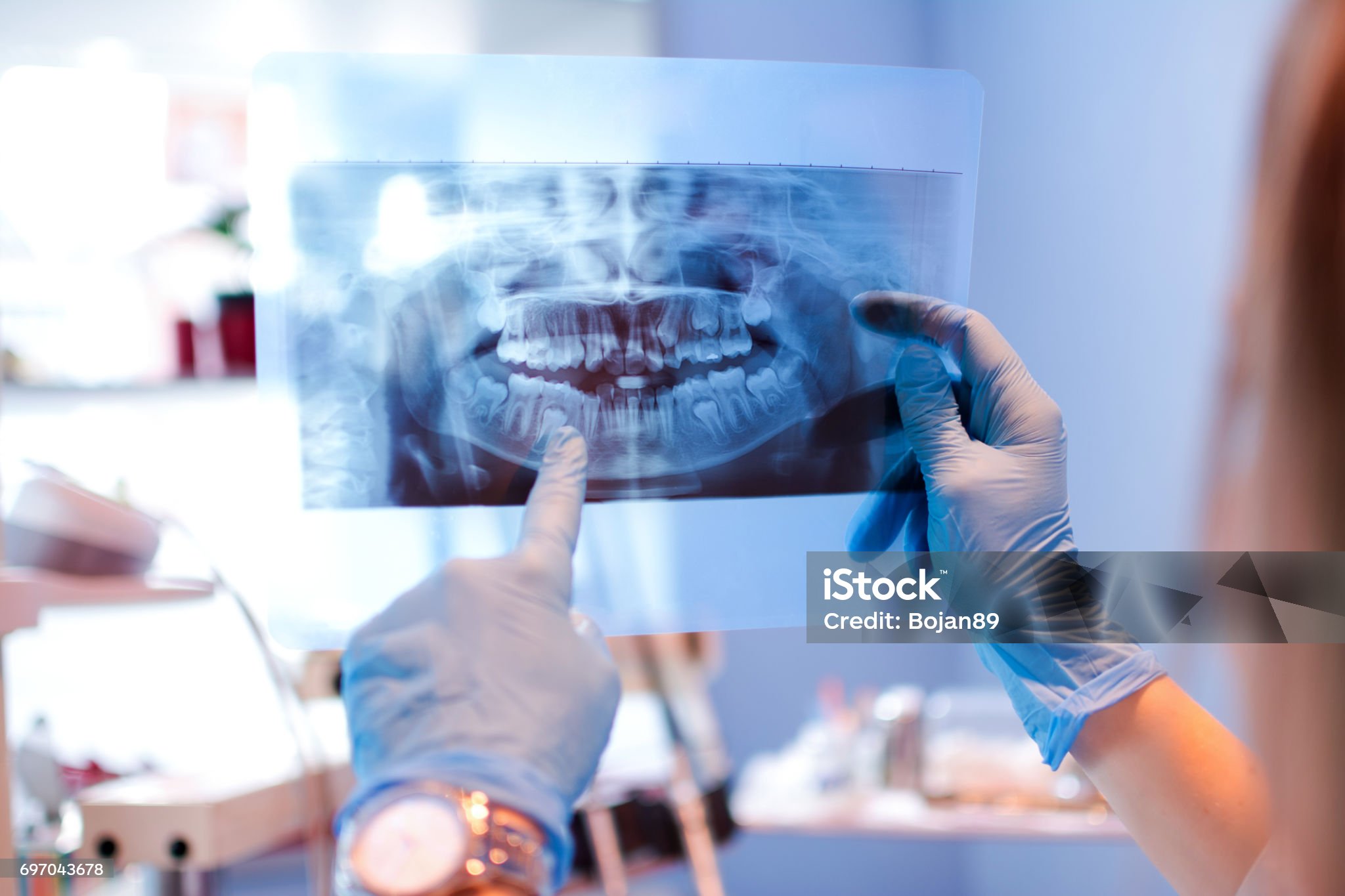 치과 영상촬영(Dental Radiography)은 어떤 것이 있을까?