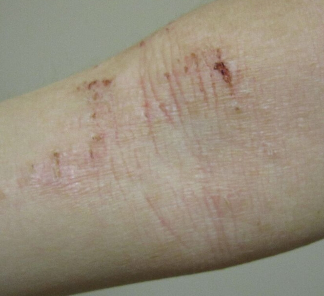 알레르기로 가려운 모습