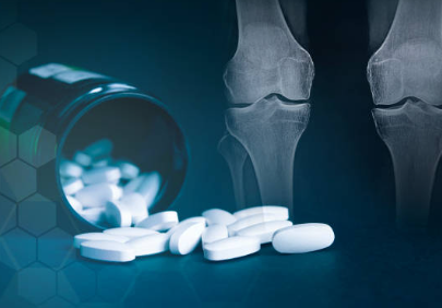 글루코사민·콘드로이틴