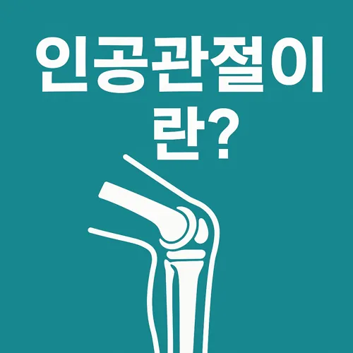 인공관절 삽입된 무릎 일러스트