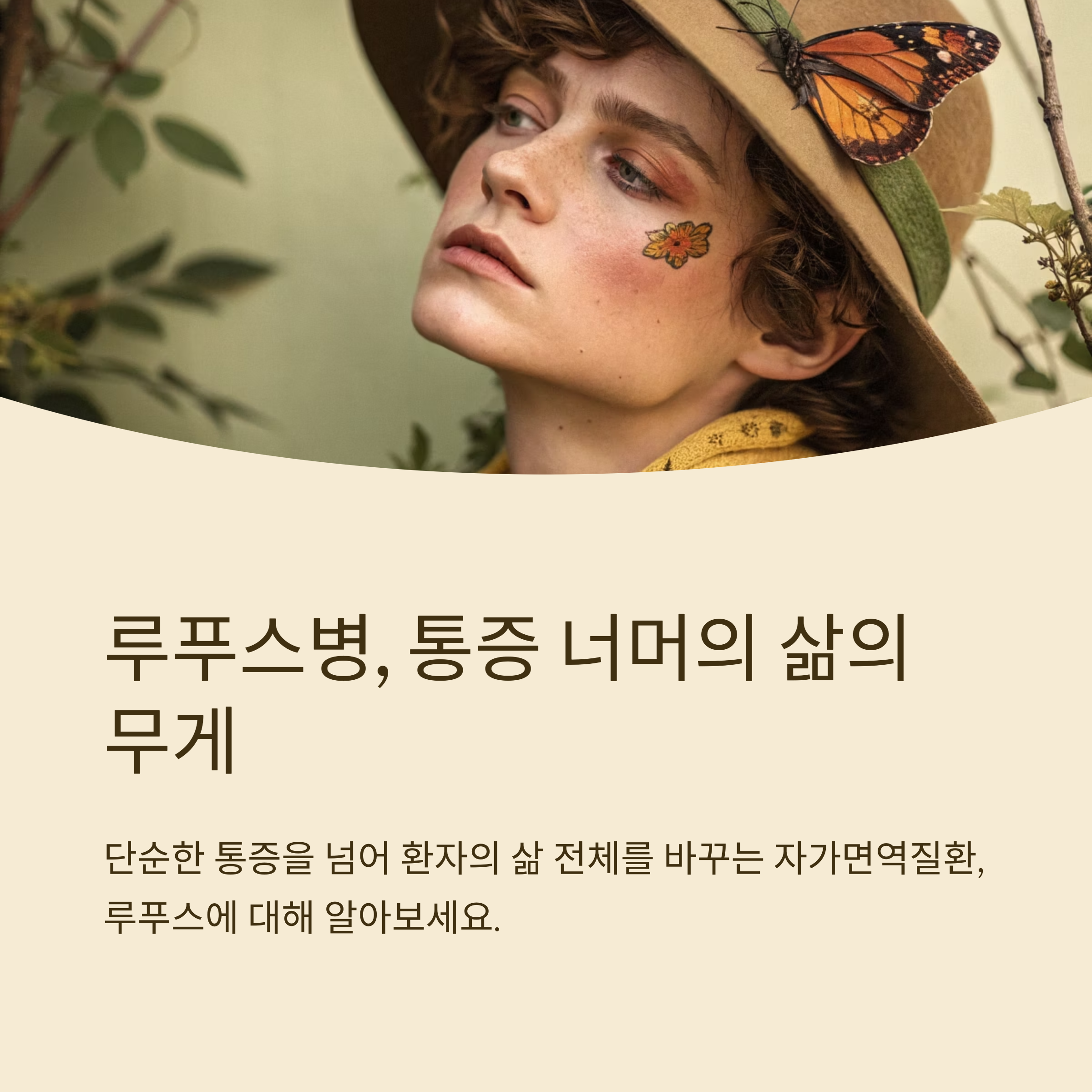 루푸스병