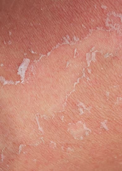 피부 각질 제거 방법