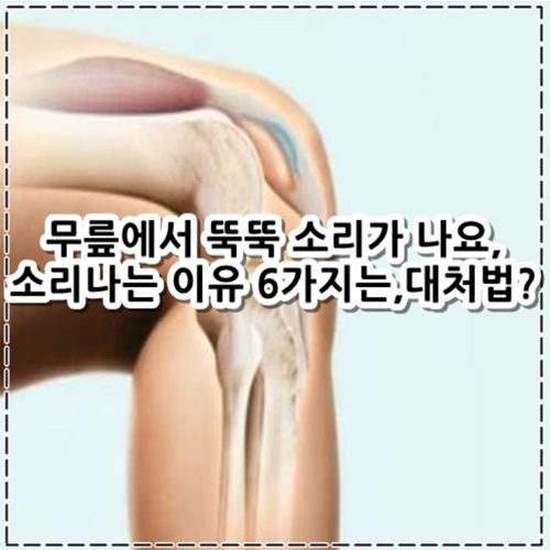 무릎에서 뚝뚝 소리가 나요, 소리나는 이유 6가지, 대처법 은?