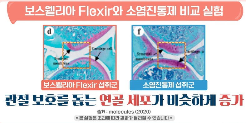 보스웰리아 플렉서