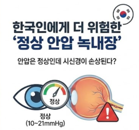 녹내장 초기증상