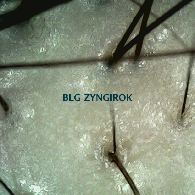 탈모 극복 프로젝트 - 정수리와 이마 사이 두피 모습이다.