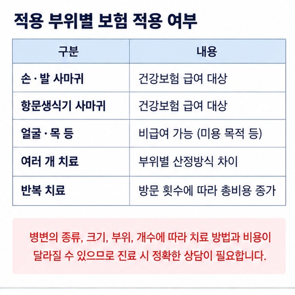 손 발 항문생식기와 얼굴 목 등 부위별 사마귀 냉동 치료 건강보험 적용과 비용 구조를 비교한 이미지