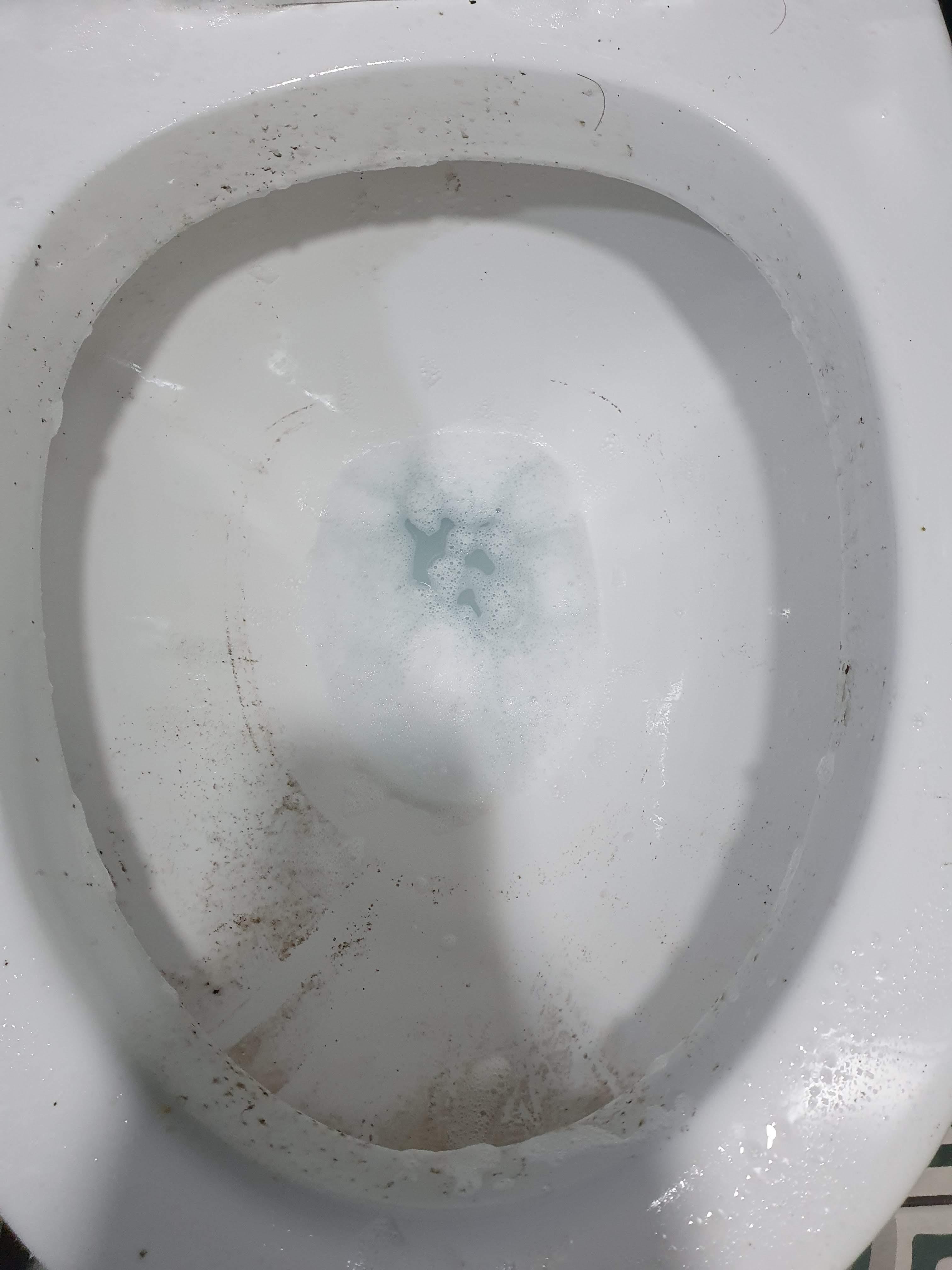 무좀샴푸