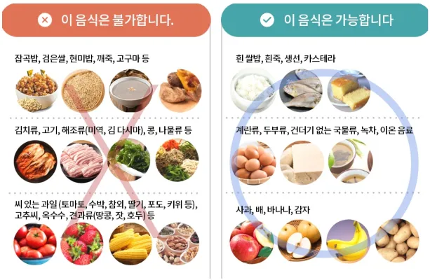 대장내시경 전 음식