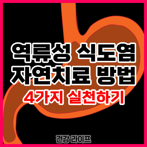 역류성 식도염 자연치료 방법