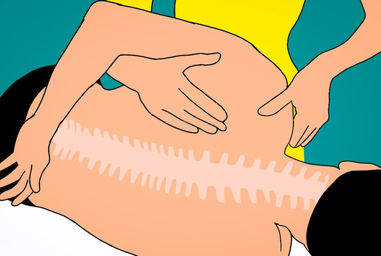 요추 염좌와 디스크 초기 구분법&amp;#44; 허리 통증 원인 바로 잡는 법