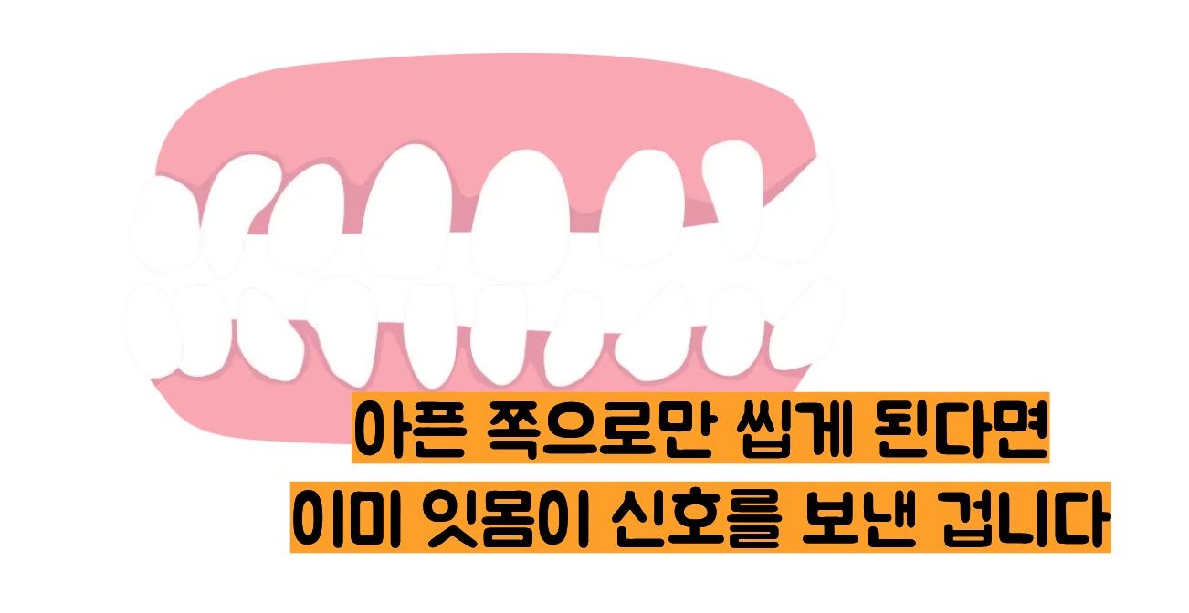 잇몸이 붓고 아플때