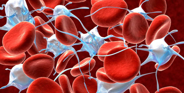 루푸스병 이란&amp;#44; 증상 및 치료 전략까지 한눈에