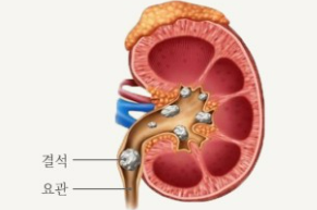 쏘팔메토의 효능 
