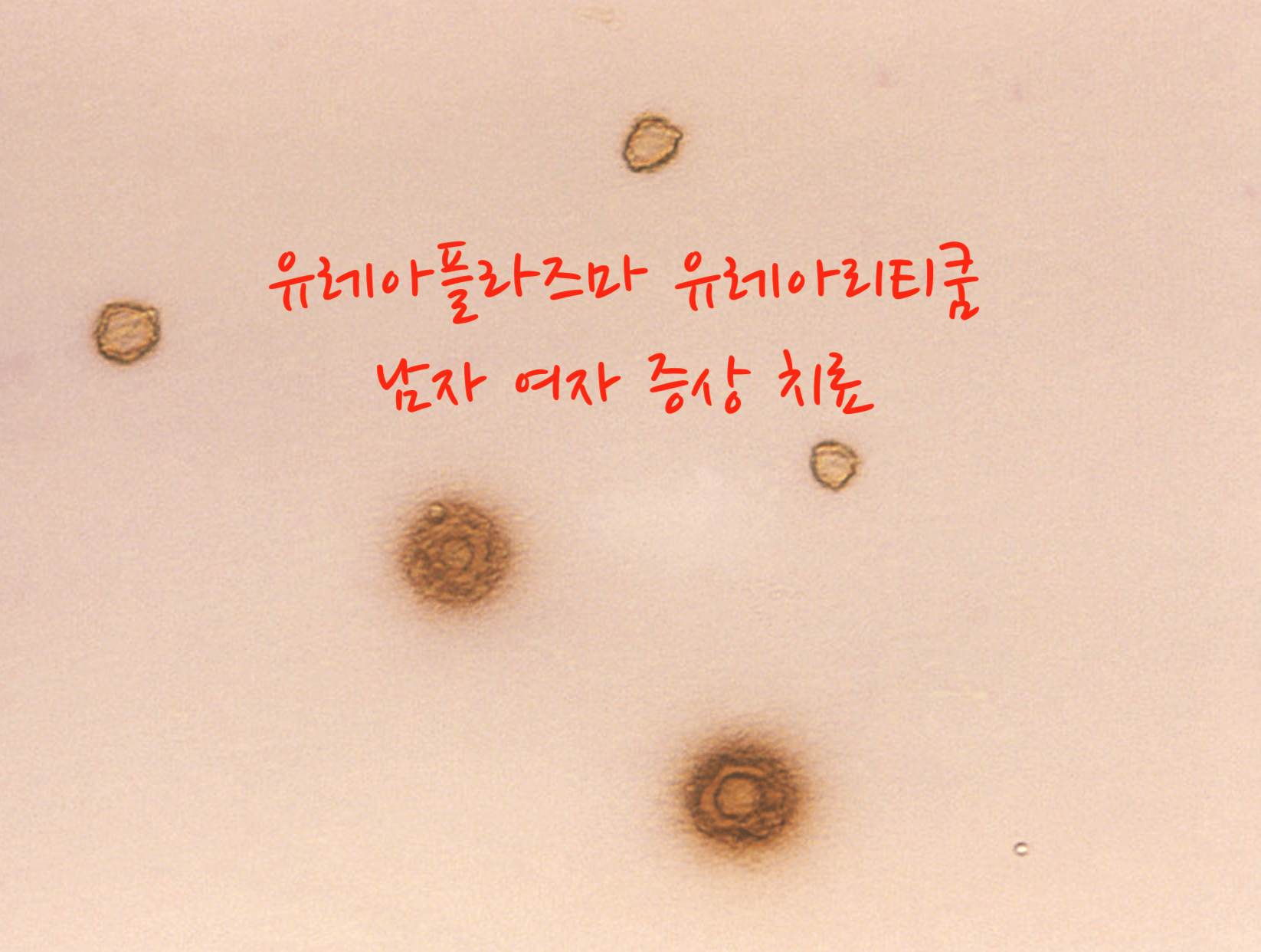 유레아플라즈마 남자