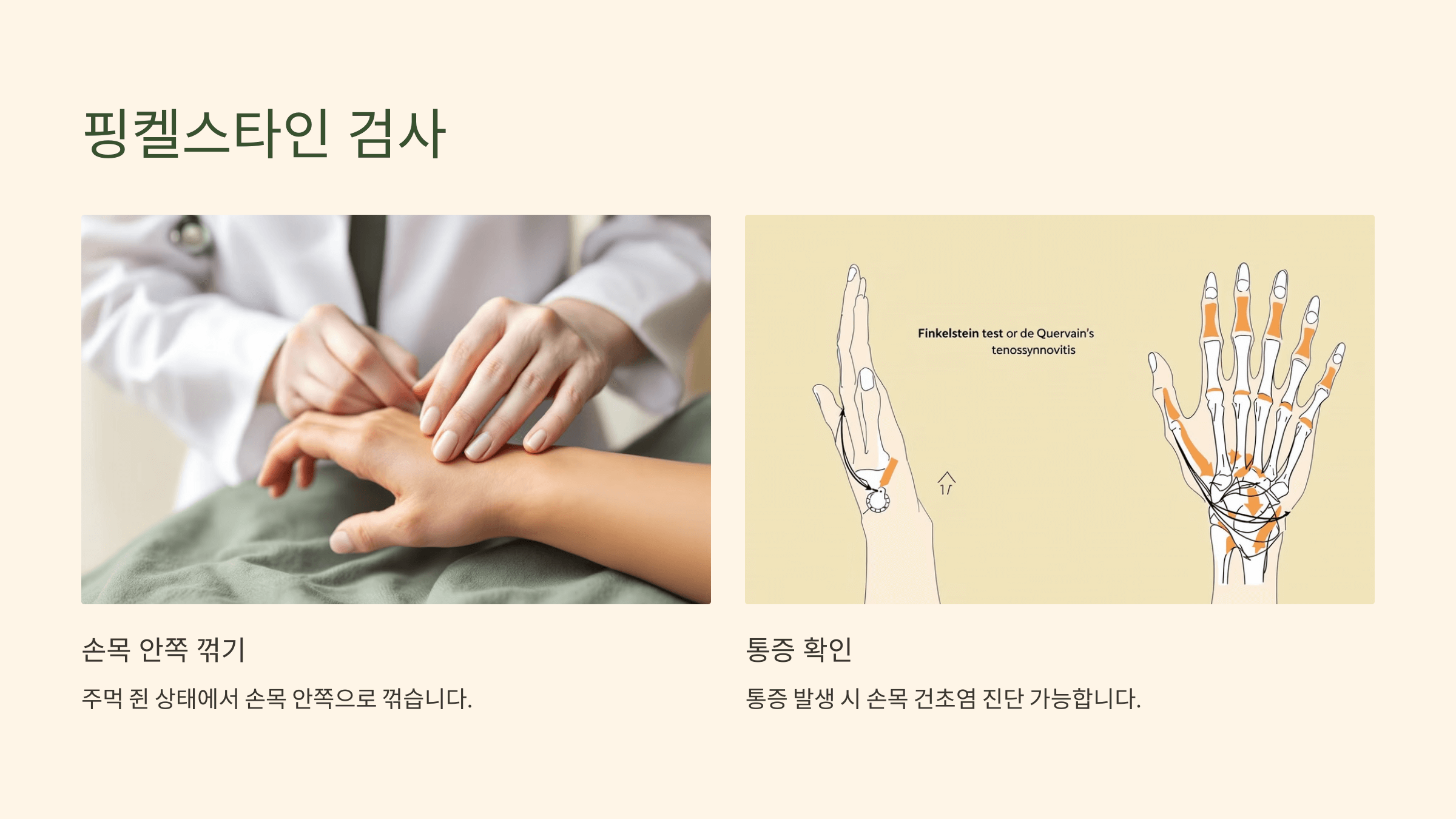 손목 건초염과 관련된 사진입니다.