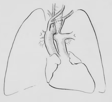 만성폐쇄성 폐질환 증상 치료 원인과 예방법