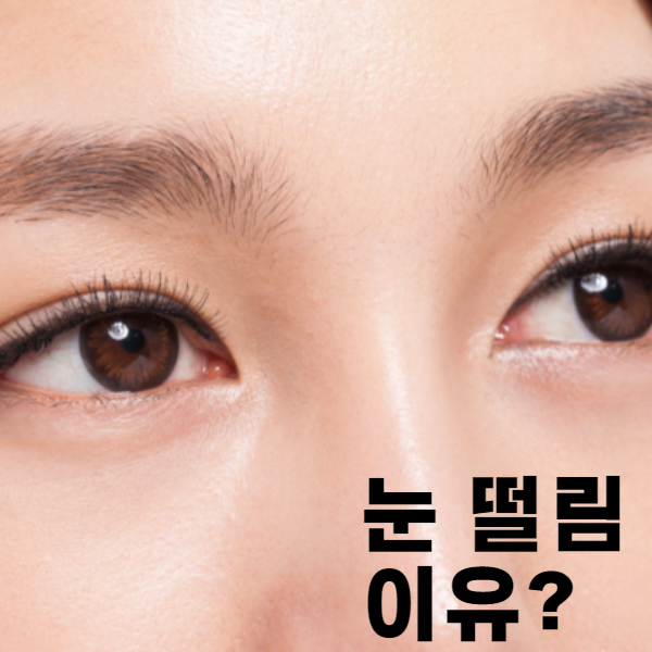 눈떨림 이유 : 눈 떨림현상