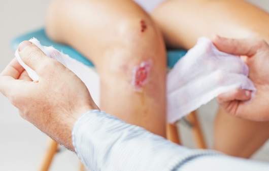 당뇨병 초기 증상