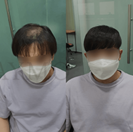 가발의여왕(메이모)