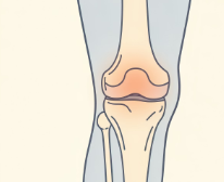 무릎 연골 손상 증상