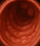 대장내시경 전 먹어도 되는음식