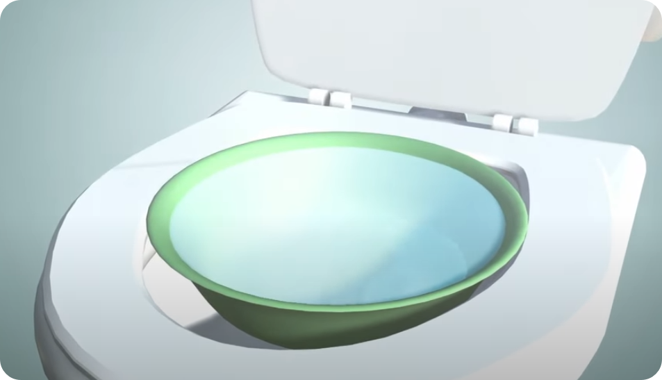 전립선좌욕사진