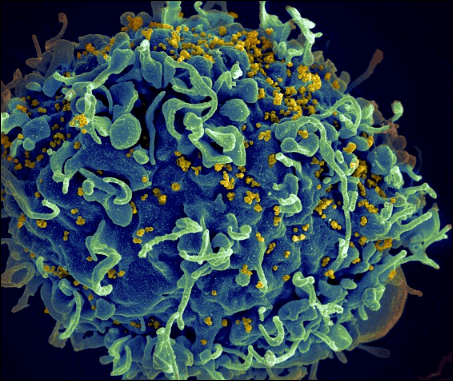 감염 3년 뒤에야 HIV 감염 통보