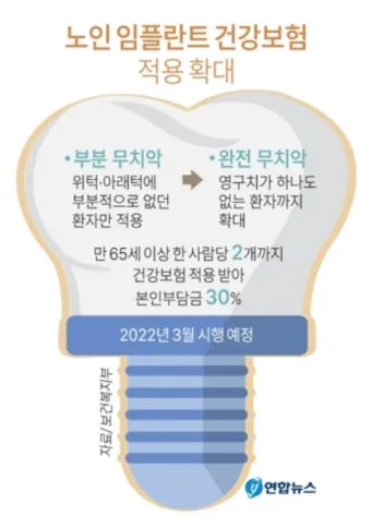 임플란트 지원 대상 건강보험 적용 연령 비용 안내_11