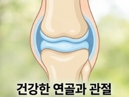 연골주사 맞고 운동해도 될까? 슬로우 조깅 시작 시기 총정리