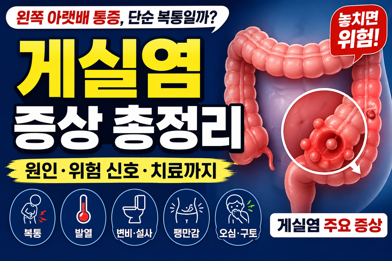 게실 질환과 게실염 증상 정리