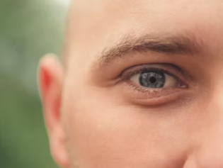 눈썹 이식 비용 가격 부작용