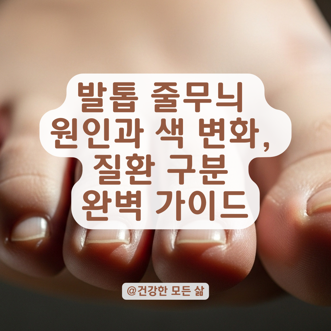 발톱 줄무늬, 검은선이나 갈색선이 계속된다면? 단순 색소침착일지 질환 신호일지 구분법 정리.