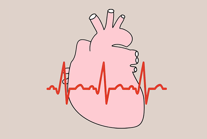 박동수가-증가한-심장