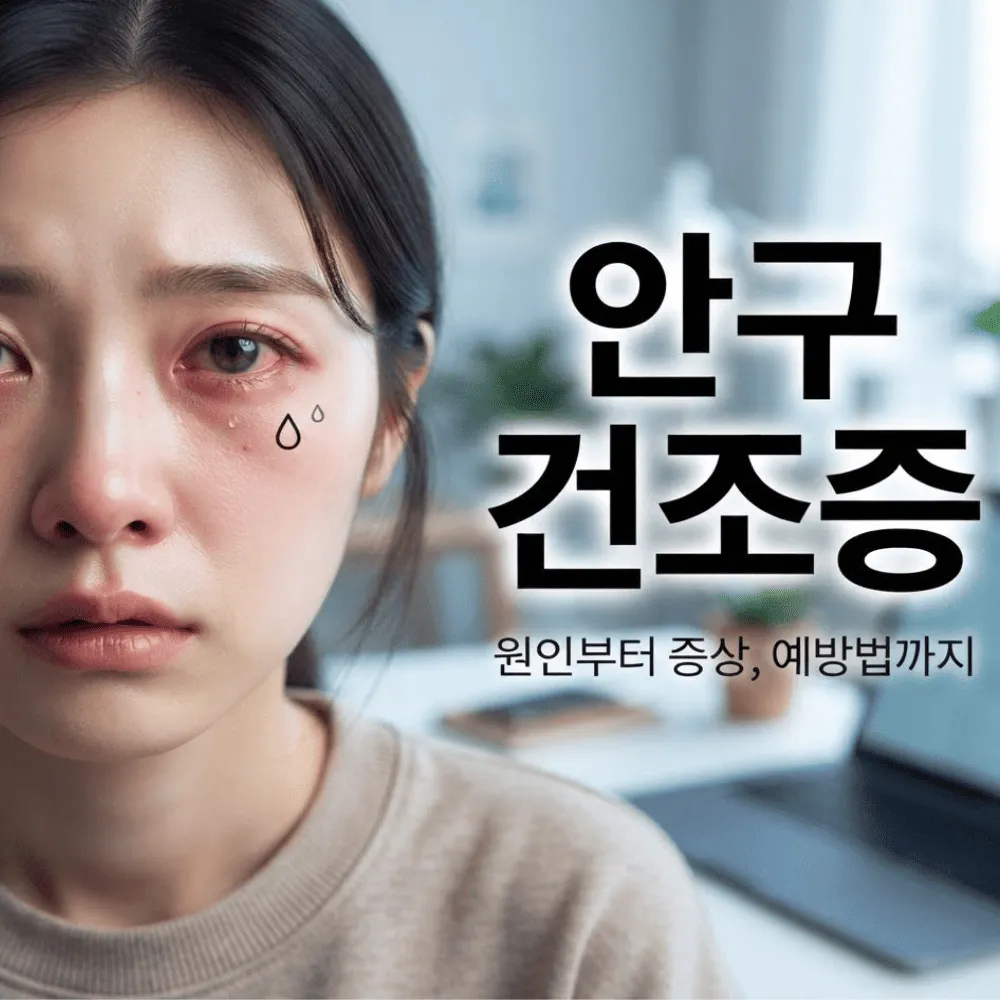 안구건조증