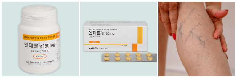 엔테론정, 하지정맥류 사진