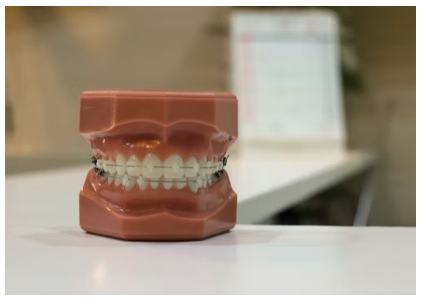 임플란트 장단점