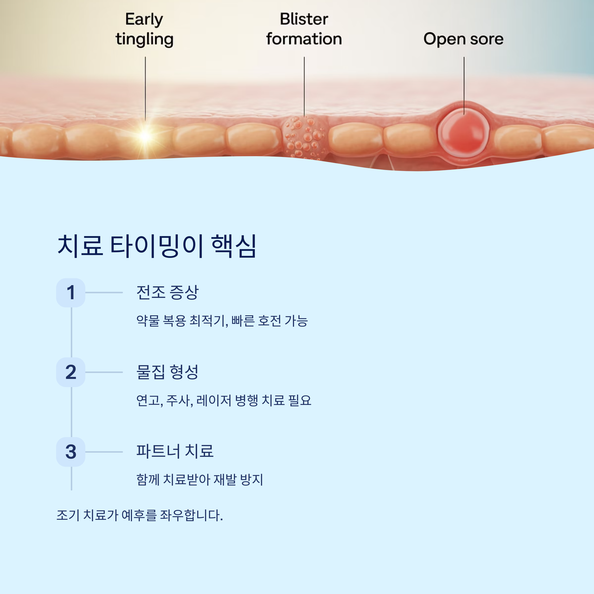 시기적 대응이 핵심,