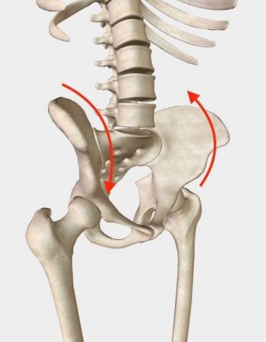 골반 비대칭 틀어짐 증상 6가지