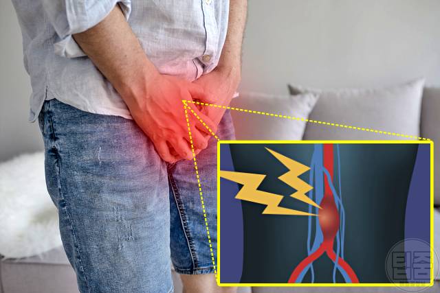 배에서 심장박동 복부대동맥류 증상 복부대동맥류 자가진단 사타구니통증 고환통증