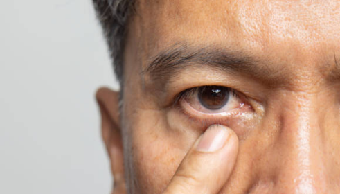 녹내장 초기증상, 실명 확률, 원인 총정리 (2024ver)