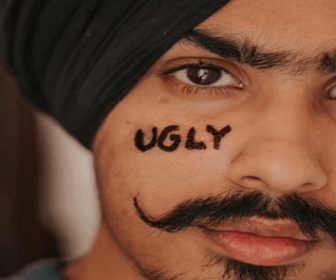 인중 수염제모 related picture 2