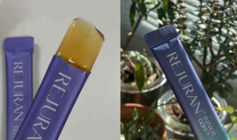 먹는 리쥬란 추천