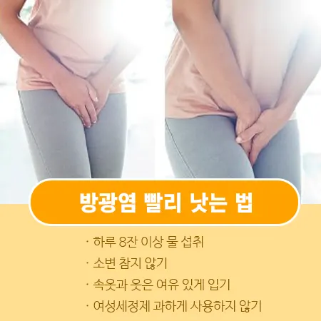 방광염 빨리 낫는 법