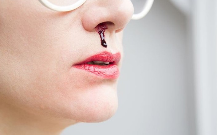 코피가-나는-이유